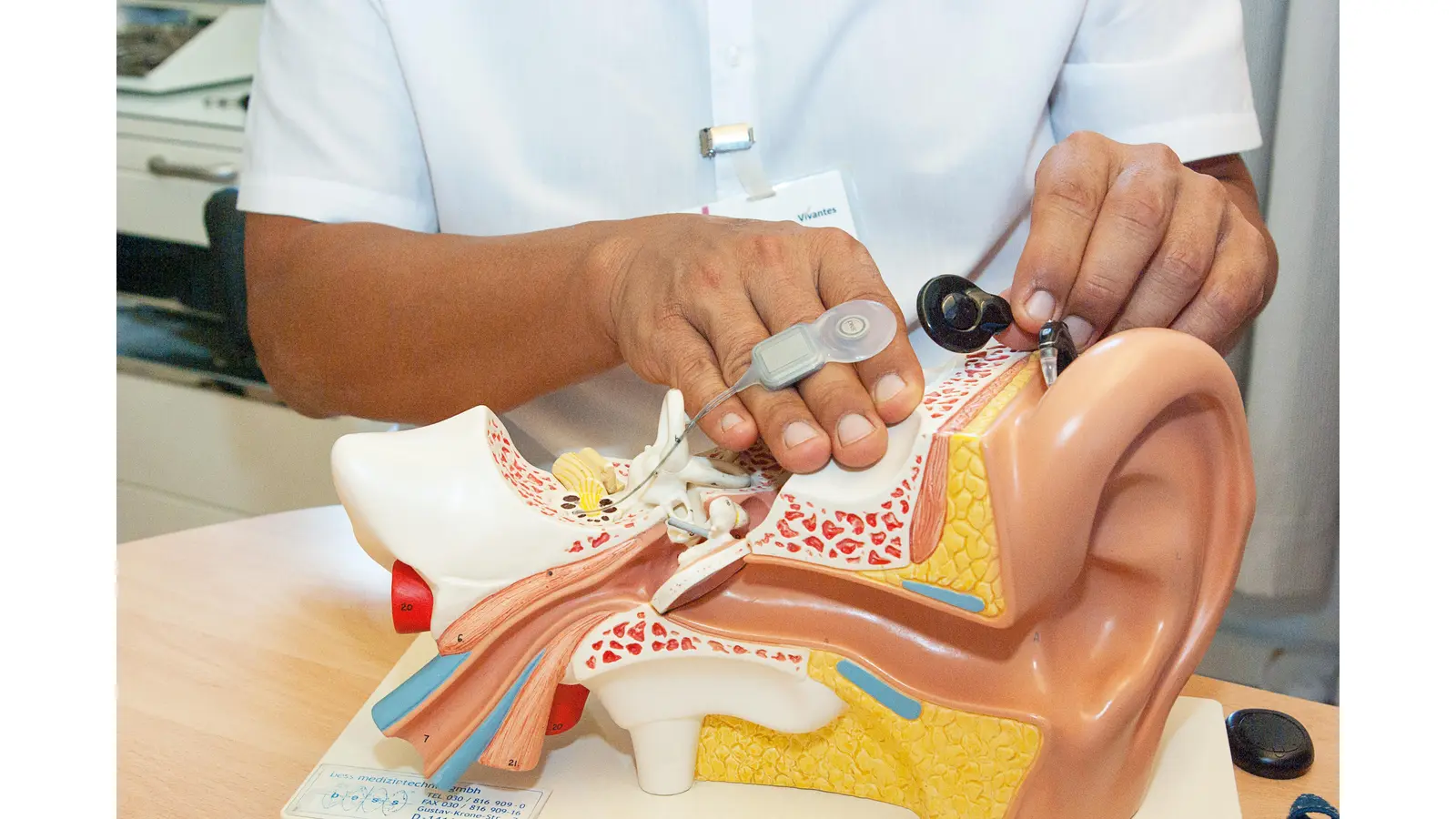 Der schwarze Audio- und Sprachprozessor sitzt außen hinter dem Ohr und überträgt codierte Schallsignale an das graue Implantat. (Foto: privat)