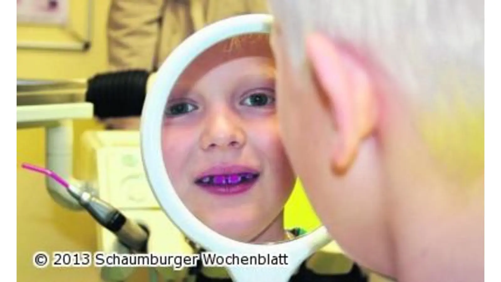 Überraschung an den Zähnen (Foto: ste)