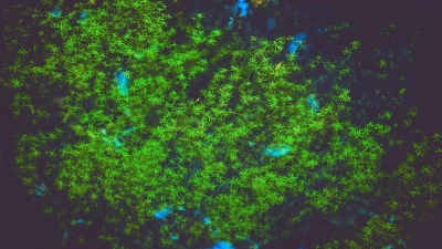 Kann sich wie eine Pest ausbreiten: Wasserpest. (Foto: pixabay)