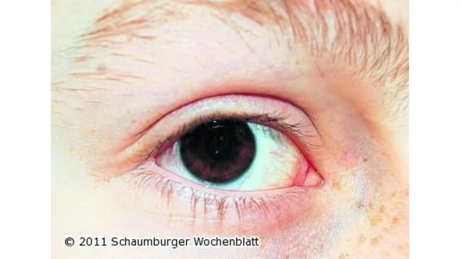 Gebrauch schädigt Augen nicht (Foto: ste)