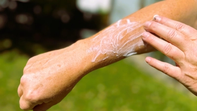 Sonnencreme ist im Sommer Pflicht, auch bei gut vorgebräunter Haut. Ist sie allerdings abgelaufen, verliert sich ihre Wirkung immer mehr. (Foto: ste)
